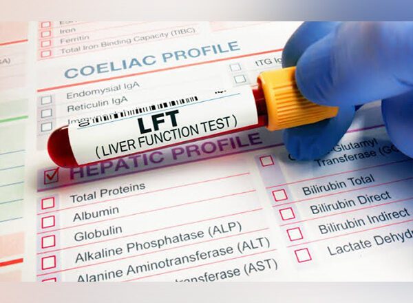 When Should You Get Liver Function Tests Done? Signs and Symptoms that Warrant Testing