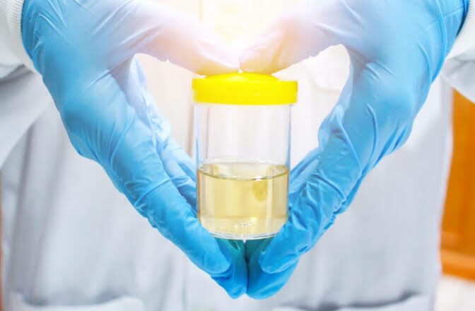 What Does a Complete Urine Examination Involve? A Step-by-step Overview