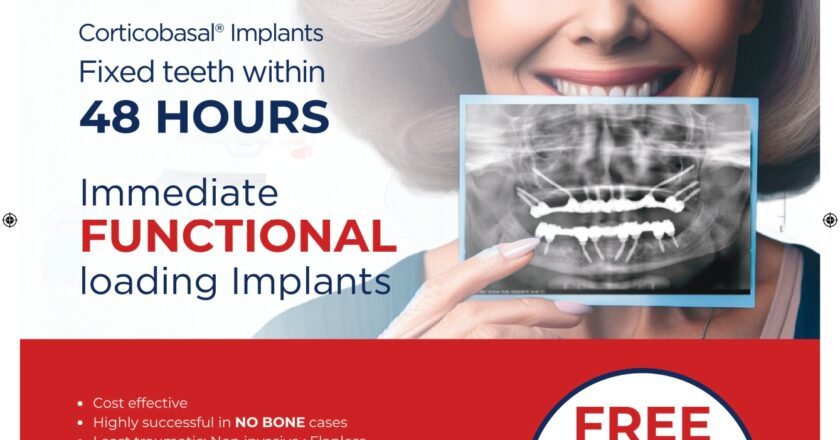 Rediscover Your Smile: Simpladent’s Revolutionary Dental Implants Transforming Lives of the Elderly