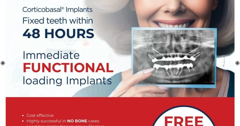 Immediate Loading Dental Implants: Simpladent Clinics Revolutionize Oral Health with 48-Hour Full Mouth Rehabilitation