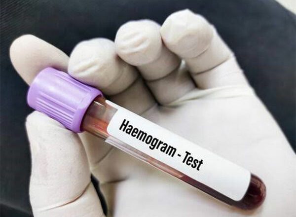 Why is a Hemogram Test Prescribed?