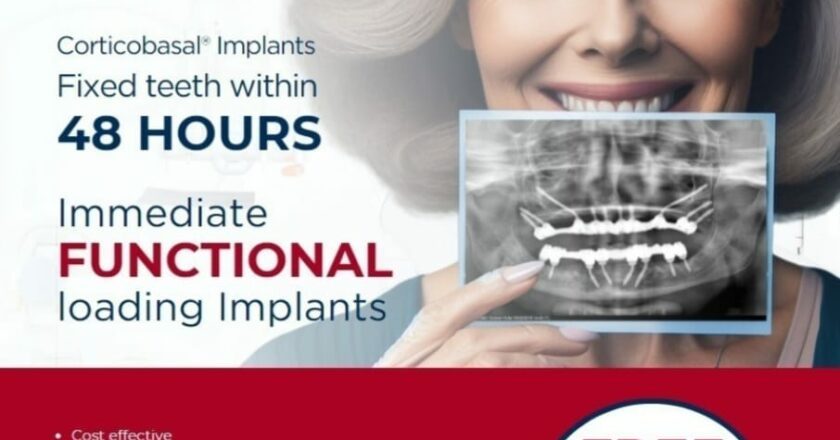 48 Hours Immediate Loading Dental Implants: A Revolutionary Solution for Older Patients