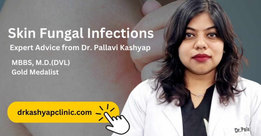 Understanding Skin Fungal Infections: Causes, Symptoms, and Treatment by Dr Pallavi Kashyap