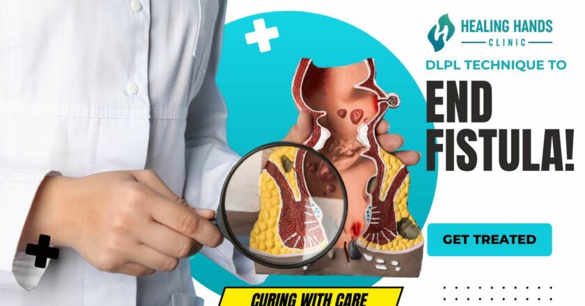How to Cure Fistula Permanently?- DLPL Fistula Treatment