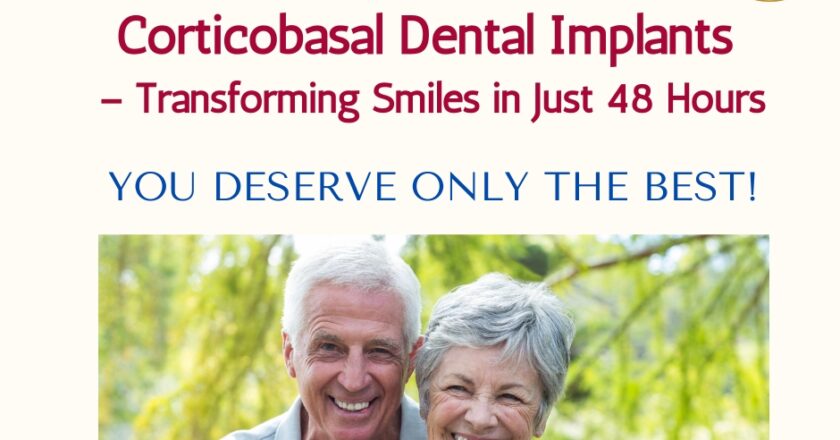 Corticobasal Dental Implants – Transforming Smiles in Just 48 Hours