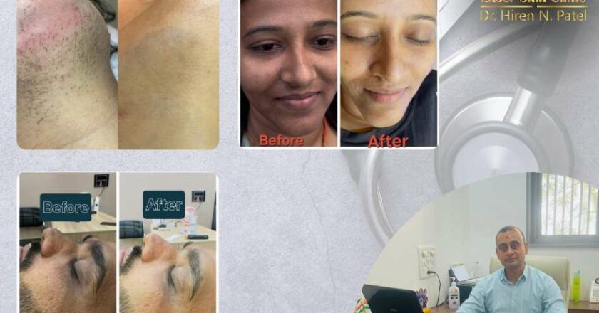 Discover Radiant Skin at Shreeji Laser Skin Clinic in Ahmedabad