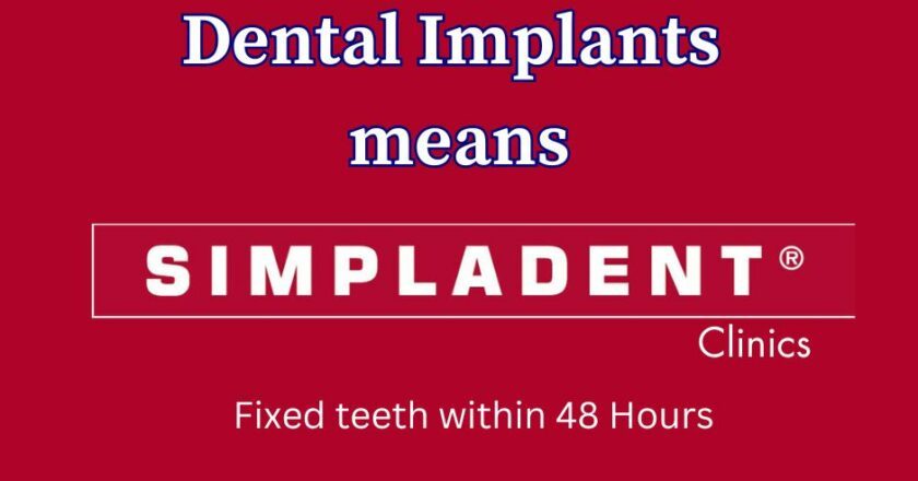 Why Choose Immediate Loading Dental Implants Over Traditional Implants?