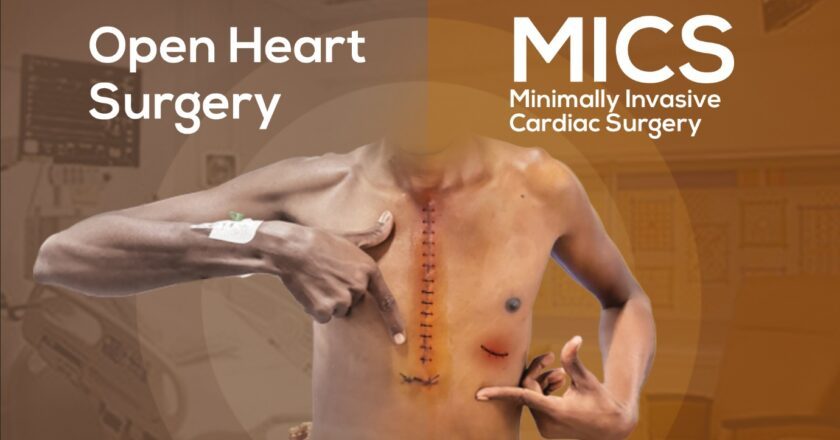 Transforming Heart Care: A Traveler’s Guide to Minimally Invasive Cardiac Surgery
