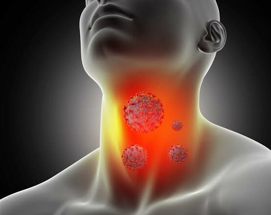 How to Treat Sore Throat?
