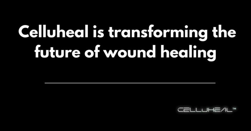 Celluheal is Transforming the Future of Wound Healing with Advanced Collagen Technology and Calcium Alginate Dressing Innovation