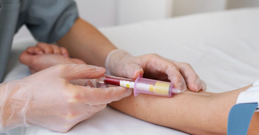 Cholesterol and Lipid Tests: Why They Matter