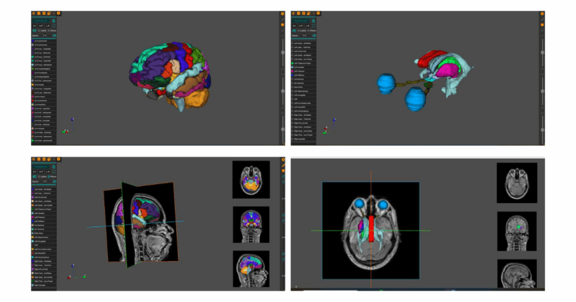 AnaVu: IIIT-Hyderabad’s 3D Anatomy Visualization Platform Transforming Medical Education