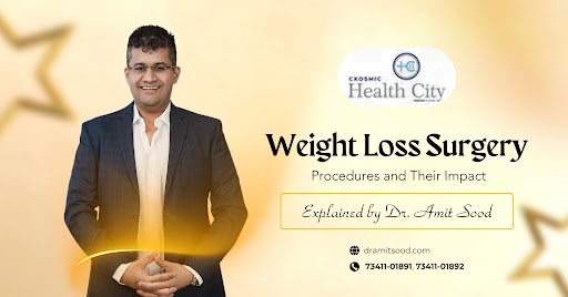 Weight Loss Surgery Procedures and Their Impact Explained by Dr. Amit Sood