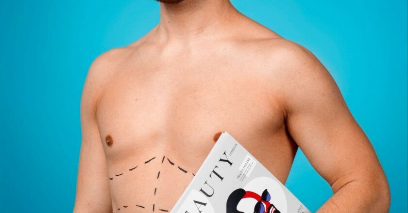Why More Men in Indian Metros Are Opting for Liposuction Over Traditional Weight-Loss Methods